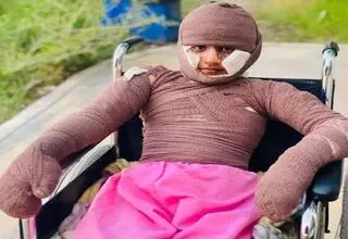 «هدا»، دختری از میناب/ مستندی درباره یکی از بازماندگان جنگ رمضان