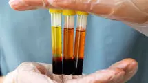 ضرورت احداث پالایشگاه ملی پلاسما
