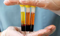 ضرورت احداث پالایشگاه ملی پلاسما