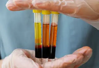ضرورت احداث پالایشگاه ملی پلاسما