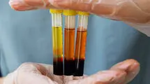 ضرورت احداث پالایشگاه ملی پلاسما