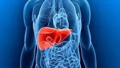 چهار عامل مهم ابتلا به کبد چرب