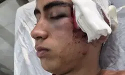 ورود دادستانی بم به پرونده تنبیه بدنی دانش‌آموز در دهبکری + عکس 