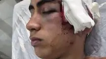 ورود دادستانی بم به پرونده تنبیه بدنی دانش‌آموز در دهبکری + عکس 