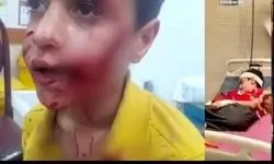 مرگ دلخراش «امیرعلی» چند روز پس از حمله خونین سگ‌ها