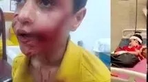 مرگ دلخراش «امیرعلی» چند روز پس از حمله خونین سگ‌ها