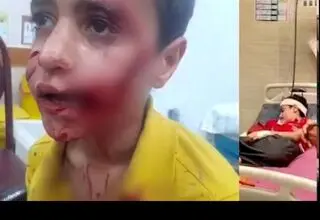 مرگ دلخراش «امیرعلی» چند روز پس از حمله خونین سگ‌ها
