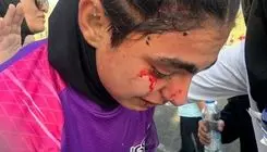 تمام حواشی هفته هشتم لیگ زنان؛ خون و خونریزی در تهران! 