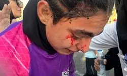 تمام حواشی هفته هشتم لیگ زنان؛ خون و خونریزی در تهران! 