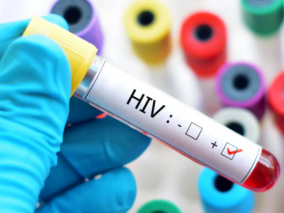پویش «من هم تست HIV می‌دهم» آغاز شد