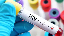 چه تعداد در ایران مبتلا به HIV هستند؟/ آمار سرایت از مادر به کودک به صفر رسیده است