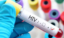 پویش «من هم تست HIV می‌دهم» آغاز شد
