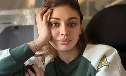 جزئیات مرگ بازیگر معروف بخاطر تزریق داروهای ضد پیری