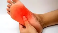 علت داغ شدن کف پا در شب‌