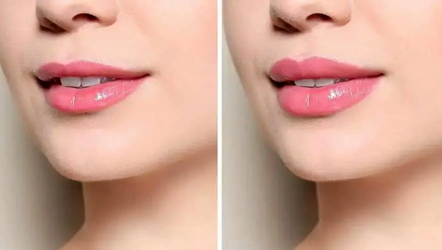 چهرههای قرضی برای دروغهای زیبایی
