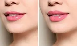 چهره‌های قرضی برای دروغ‌های زیبایی