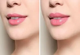 چهره‌های قرضی برای دروغ‌های زیبایی