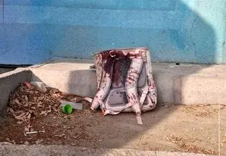 تصاویری از‌۳۹‌ کودک مجروح زیر ۵ سال در بیمارستان‌ها