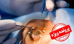 ایران در پیوند قرنیه بی‌نیاز است