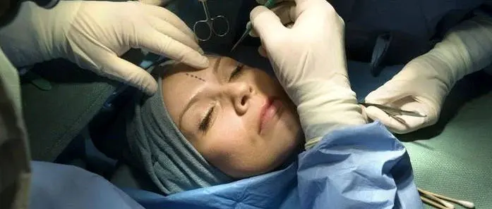 ابعاد اجتماعی عمل های پلاستیکی