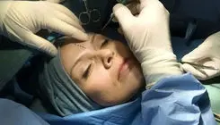 ابعاد اجتماعی عمل های پلاستیکی