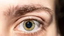 چگونه چشمانی زیبا و پرنور داشته باشیم؟