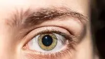 در شرایط جنگی چگونه از چشم‌ها محافظت کنیم؟
