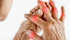 دشمن روماتیسم