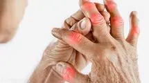دشمن روماتیسم