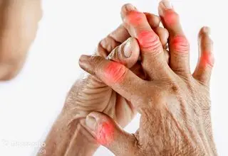 دشمن روماتیسم