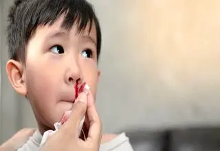 خون دماغ و راه های درمان آن