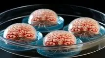 مغزهای رشدیافته در آزمایشگاه! 