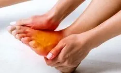 داغ شدن کف پا نشانه چیست؟