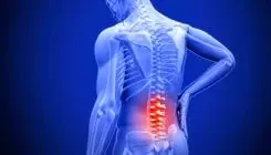 عامل باورنکردنی کمردردهای مزمن