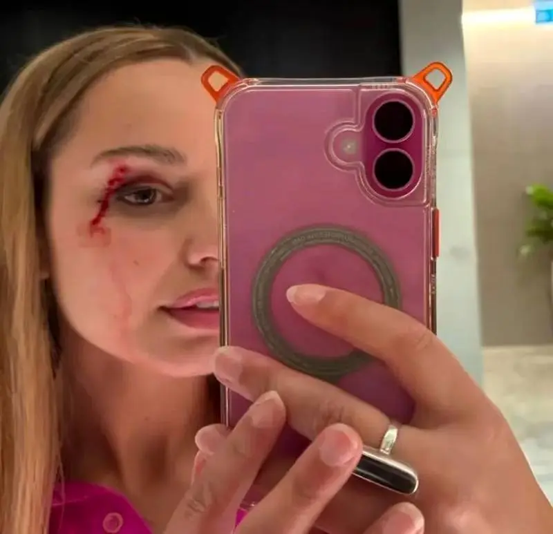 حمله یک پرنده به خانم خبرنگار در پخش زنده