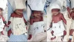 مادر جوان 5قلو به دنیا آورد