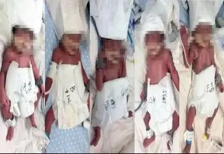 مادر جوان 5قلو به دنیا آورد
