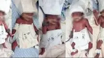 مادر جوان 5قلو به دنیا آورد