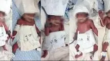 مادر جوان 5قلو به دنیا آورد