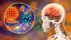 آخرین وضعیت بیماری نیپا اعلام شد