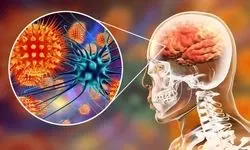 آخرین وضعیت بیماری نیپا اعلام شد