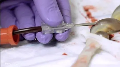 اکسیر جادویی یک خون خاص