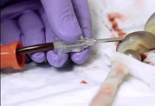 اکسیر جادویی یک خون خاص