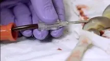 اکسیر جادویی یک خون خاص