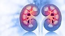 سلامت مغز با عملکرد کلیه‌ها مرتبط است