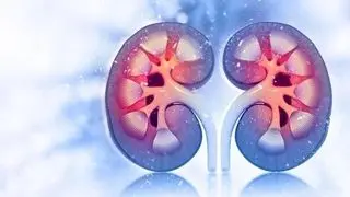 عوامل اصلی سنگ کلیه را بشناسید