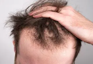 خطر ریزش مو در کمین کارکنان شیفت شب!