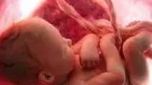 بلایی که نیکوتین بر سر جفت جنین می‌آورد