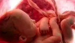 بلایی که نیکوتین بر سر جفت جنین می‌آورد