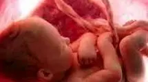 بلایی که نیکوتین بر سر جفت جنین می‌آورد
